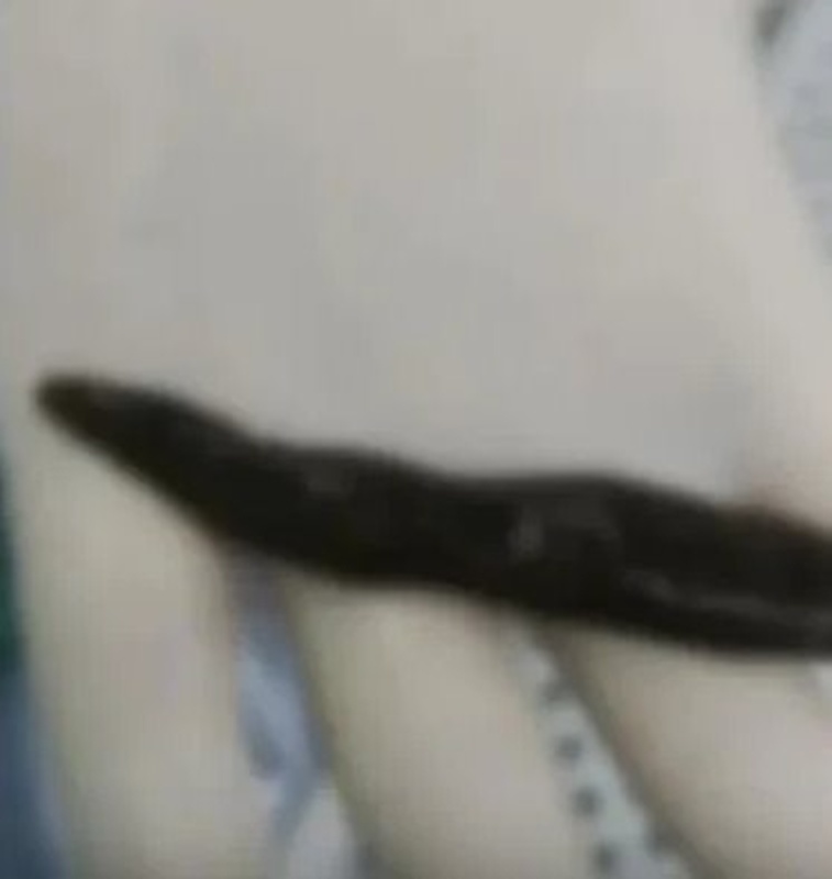 ปวดท้อง