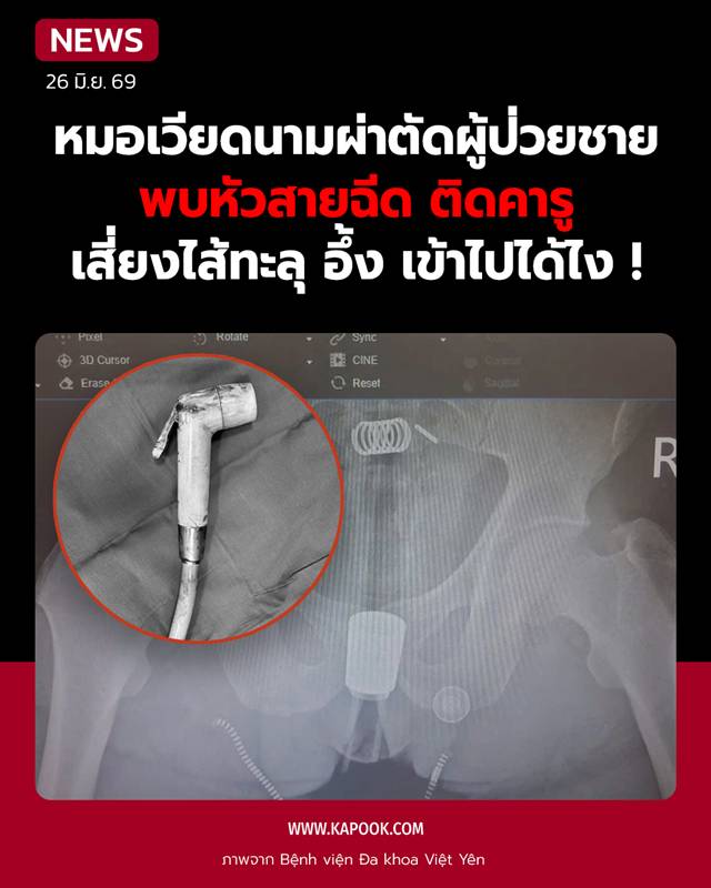 หัวฉีดชำระคารูทวาร