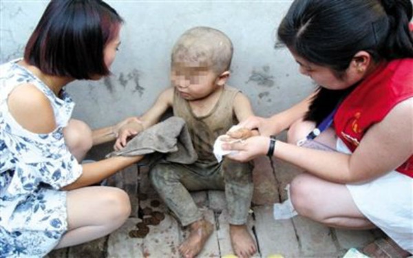 รุดช่วยเด็กชาย 7 ขวบ ใช้ชีวิตในคอกหมูเหม็นโฉ่นานนับปี