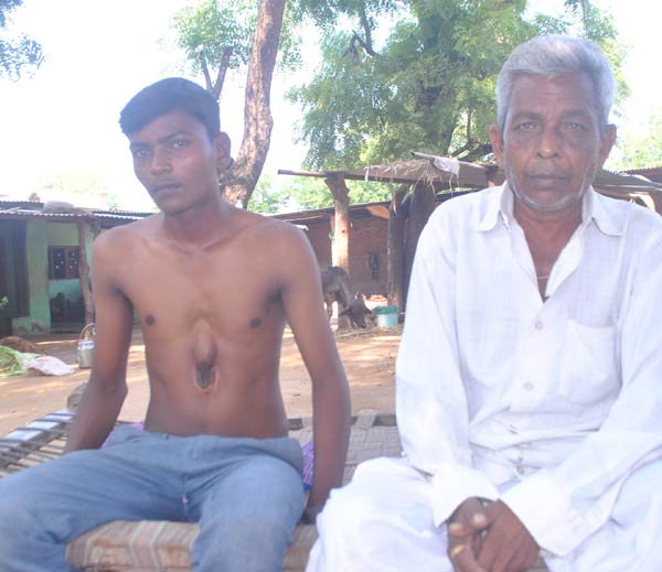 อาปิต โกฮิล