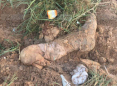 ขามนุษย์