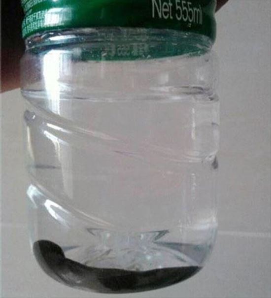 ขนลุก ปลิงเติบโตในคอเด็กชาย ผ่าออกมาได้ตัวขนาดนี้