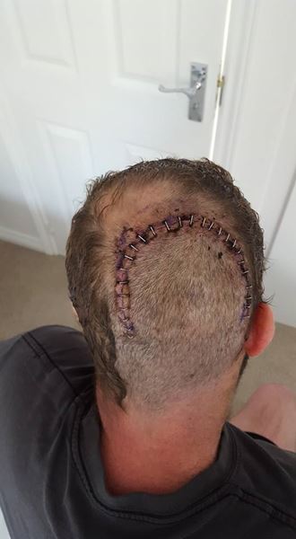 ฟิล ค็อก