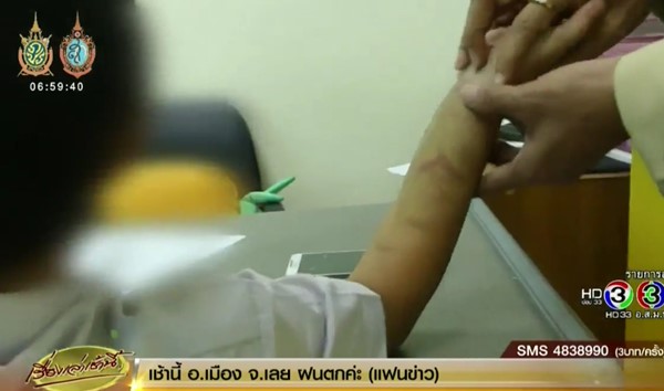 ลูกศิษย์วัย 7 ขวบ ถูกทอมแฟนใหม่แม่ทำร้ายร่างกาย