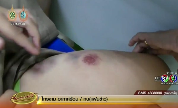 ลูกศิษย์วัย 7 ขวบ ถูกทอมแฟนใหม่แม่ทำร้ายร่างกาย
