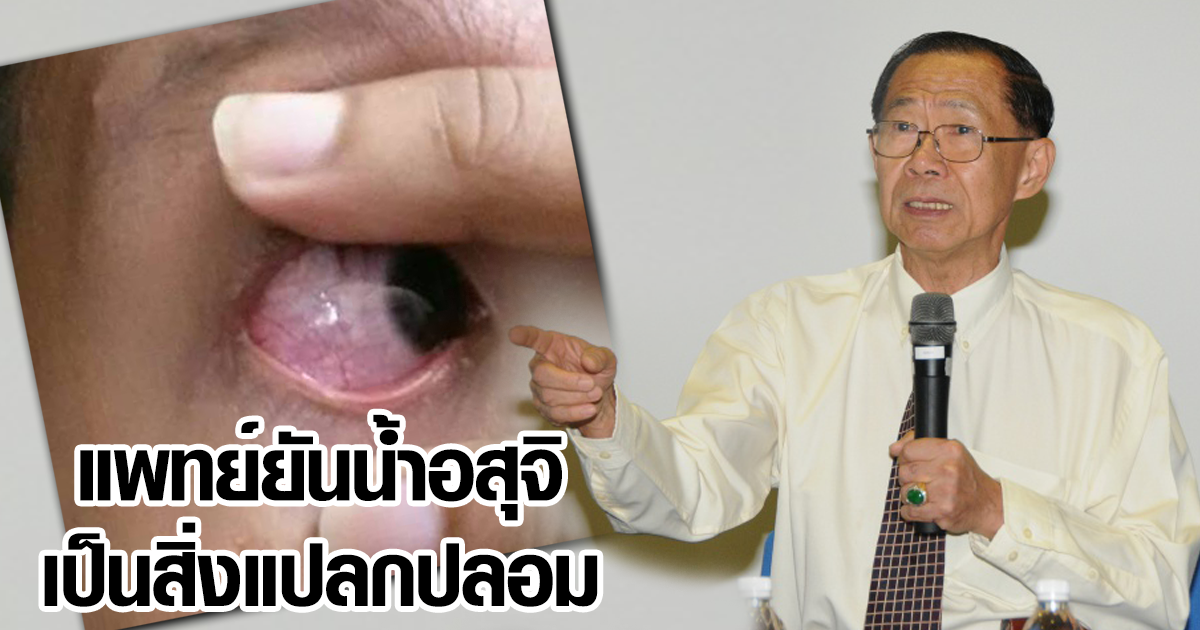 น้ำอสุจิ