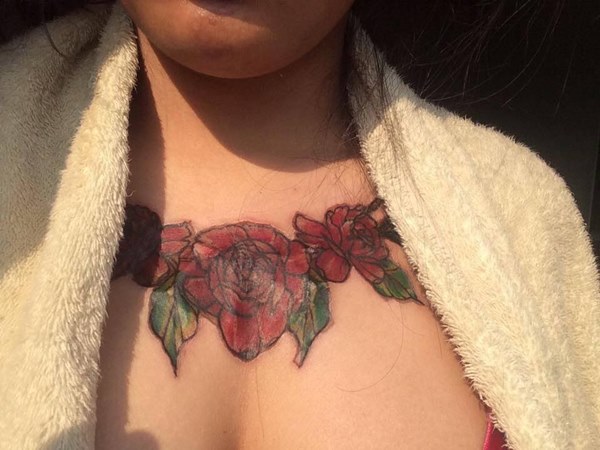 ลบรอยสัก