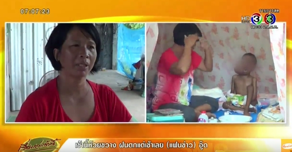 วอนช่วย เด็กชาย 5 ขวบ ป่วยมะเร็งบนใบหน้า