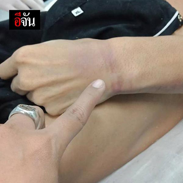 แฟนตายในคุก หมอบอกสำลักข้าวดับ