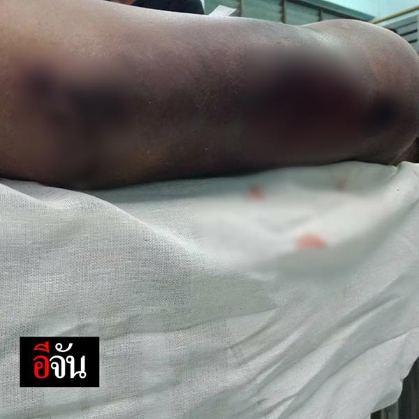 แฟนตายในคุก หมอบอกสำลักข้าวดับ