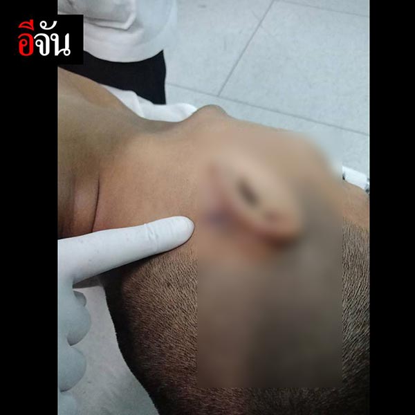 แฟนตายในคุก หมอบอกสำลักข้าวดับ