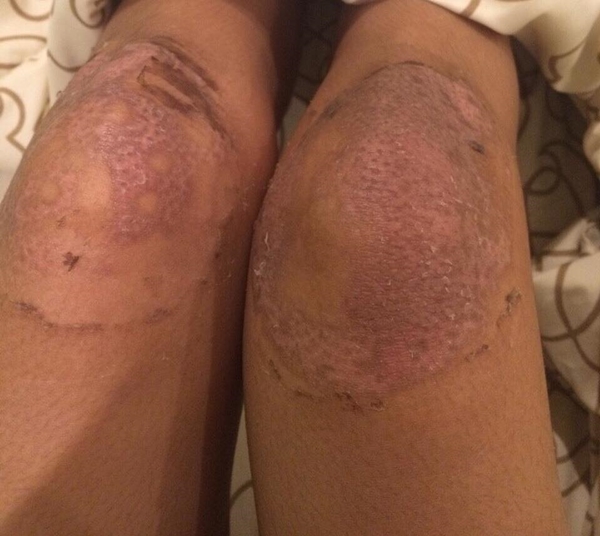 เตือน ! สาว ๆ อย่าใช้ยาผิดสรรพคุณ-คำเตือน ไม่งั้นอาจเป็นแบบนี้