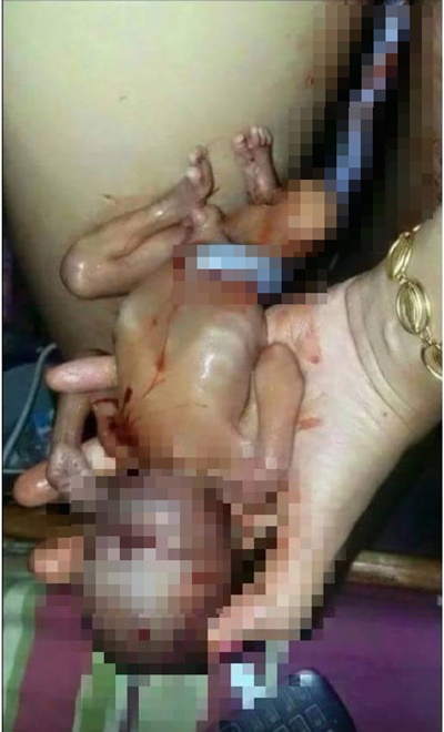  ภาพฉาวสาวทำแท้งประชดรักว่อนเน็ต ตัดต่อหรือไม่