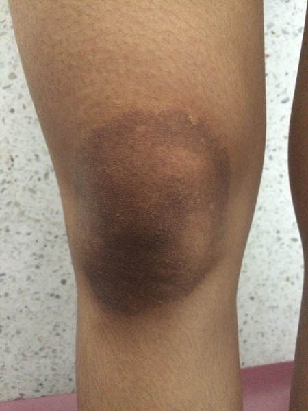 เตือน ! สาว ๆ อย่าใช้ยาผิดสรรพคุณ-คำเตือน ไม่งั้นอาจเป็นแบบนี้