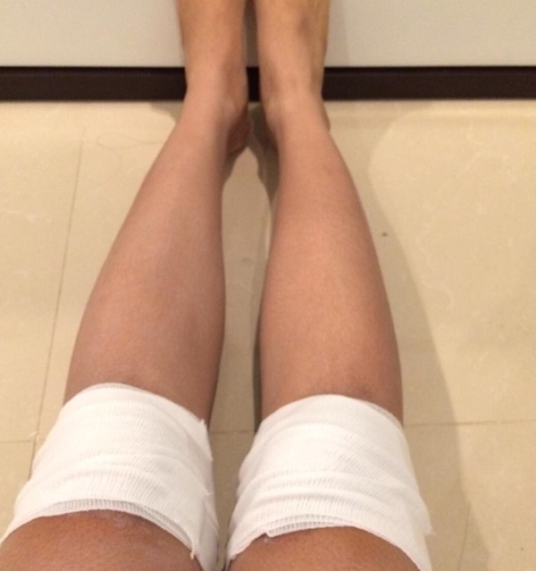 เตือน ! สาว ๆ อย่าใช้ยาผิดสรรพคุณ-คำเตือน ไม่งั้นอาจเป็นแบบนี้