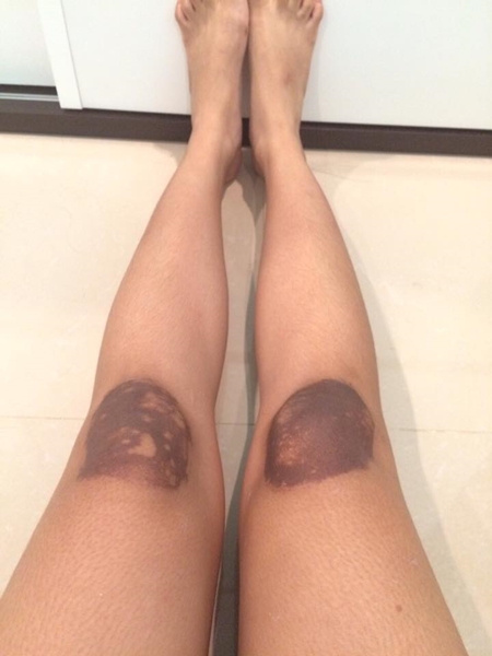 เตือน ! สาว ๆ อย่าใช้ยาผิดสรรพคุณ-คำเตือน ไม่งั้นอาจเป็นแบบนี้