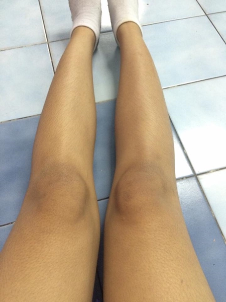 เตือน ! สาว ๆ อย่าใช้ยาผิดสรรพคุณ-คำเตือน ไม่งั้นอาจเป็นแบบนี้