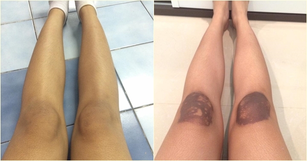 เตือน ! สาว ๆ อย่าใช้ยาผิดสรรพคุณ-คำเตือน ไม่งั้นอาจเป็นแบบนี้