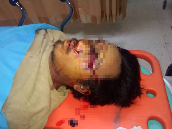 พ่อโวยชื่อลูกชายที่ตายเมื่อปี 55 โผล่ข่าวถูกฆ่าดับ เหตุเป็นกิ๊กชาวบ้าน