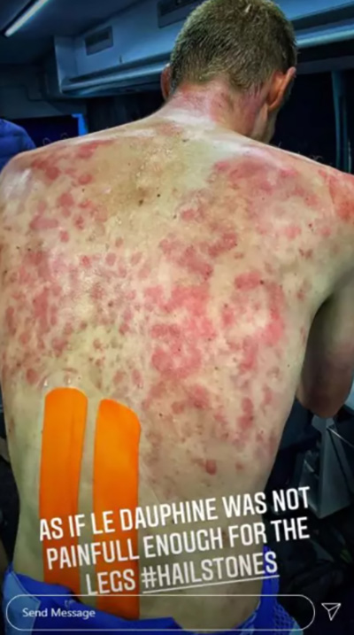 นักปั่นโชว์แผ่นหลัง