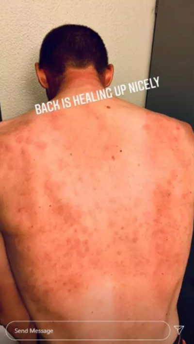 นักปั่นโชว์แผ่นหลัง