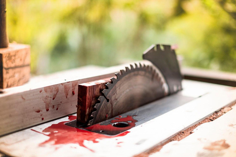 สาวตัดมือตัวเอง