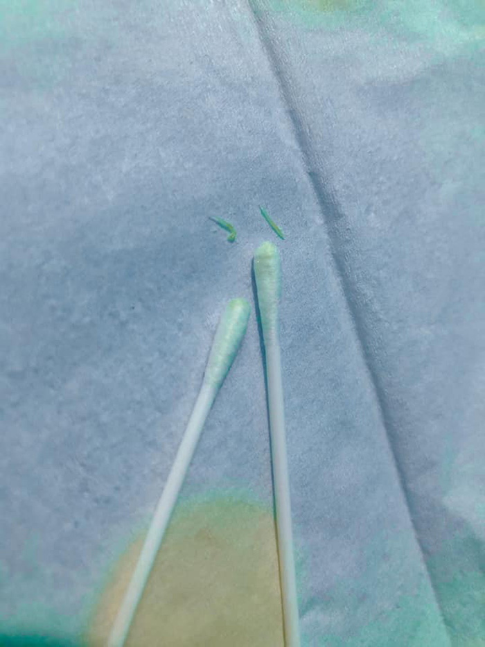 คุณแม่แชร์ประสบการณ์