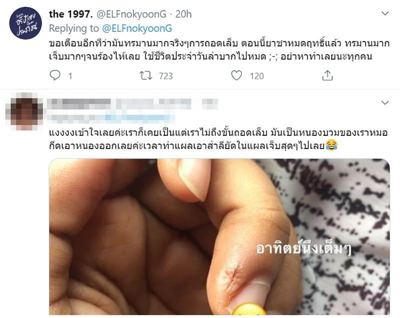 ภาพข่าว ดึงจมูกเล็บ 