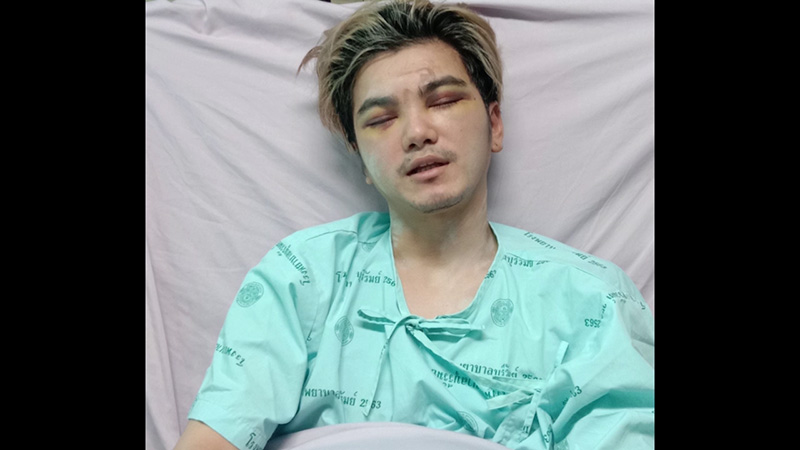 นักเต้นรองแชมป์โลก 