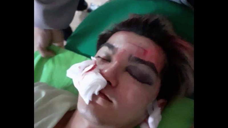 นักเต้นรองแชมป์โลก 