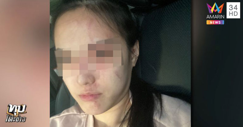 ถูกแฟนทำร้าย