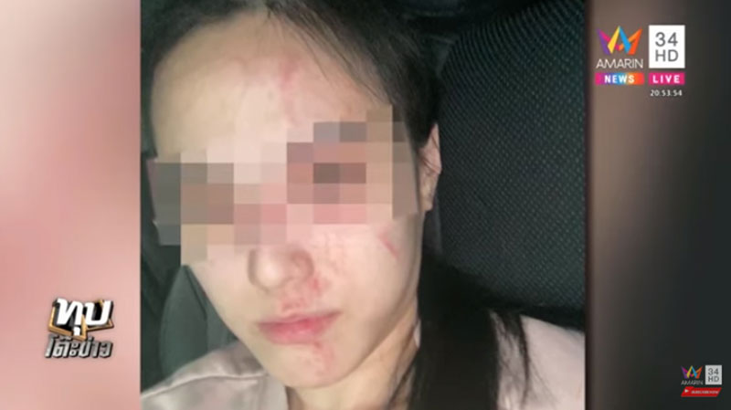 ถูกแฟนทำร้าย