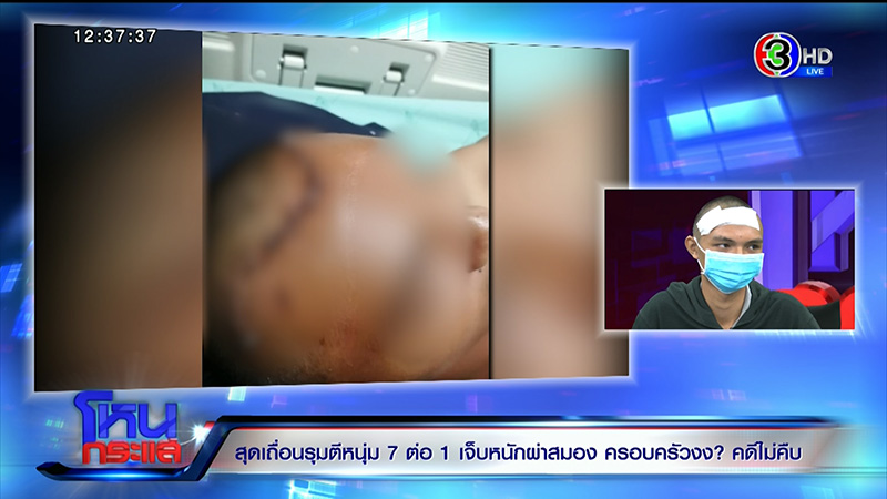 ภาพข่าวหนุ่มถูกรุมกระทืบ