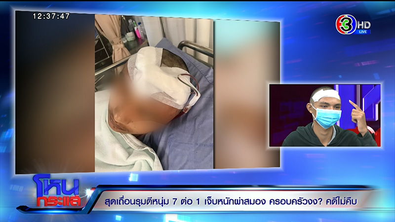 ภาพข่าวหนุ่มถูกรุมกระทืบ