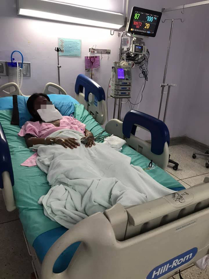 อุทาหรณ์กินไอบูโพรเฟน