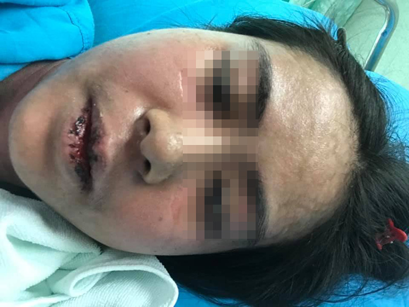 อุทาหรณ์กินไอบูโพรเฟน