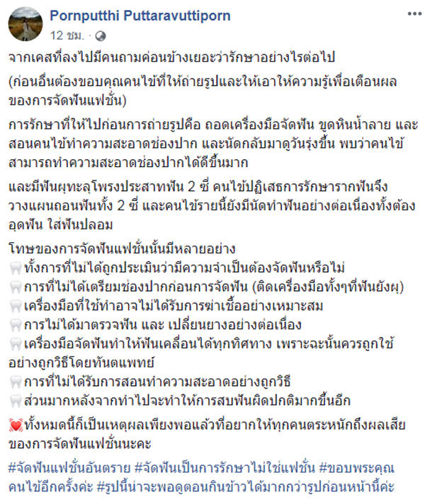 สาวจัดฟันแฟชั่น