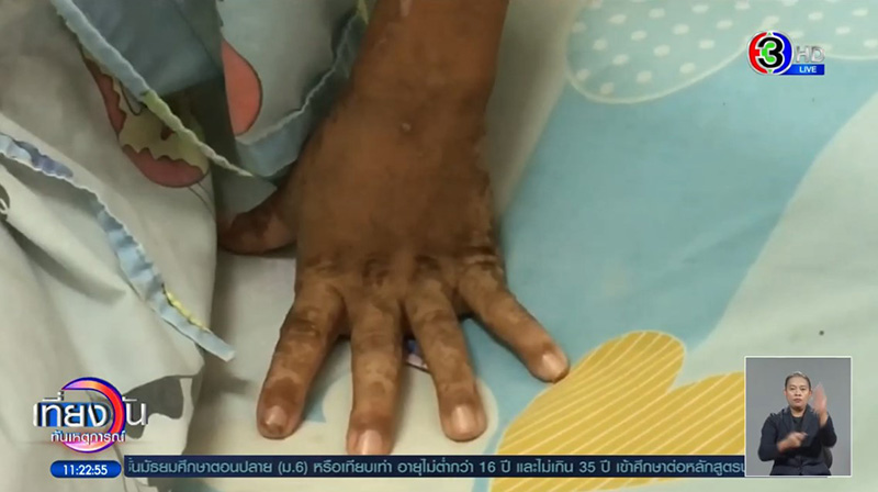 น้องภูผา