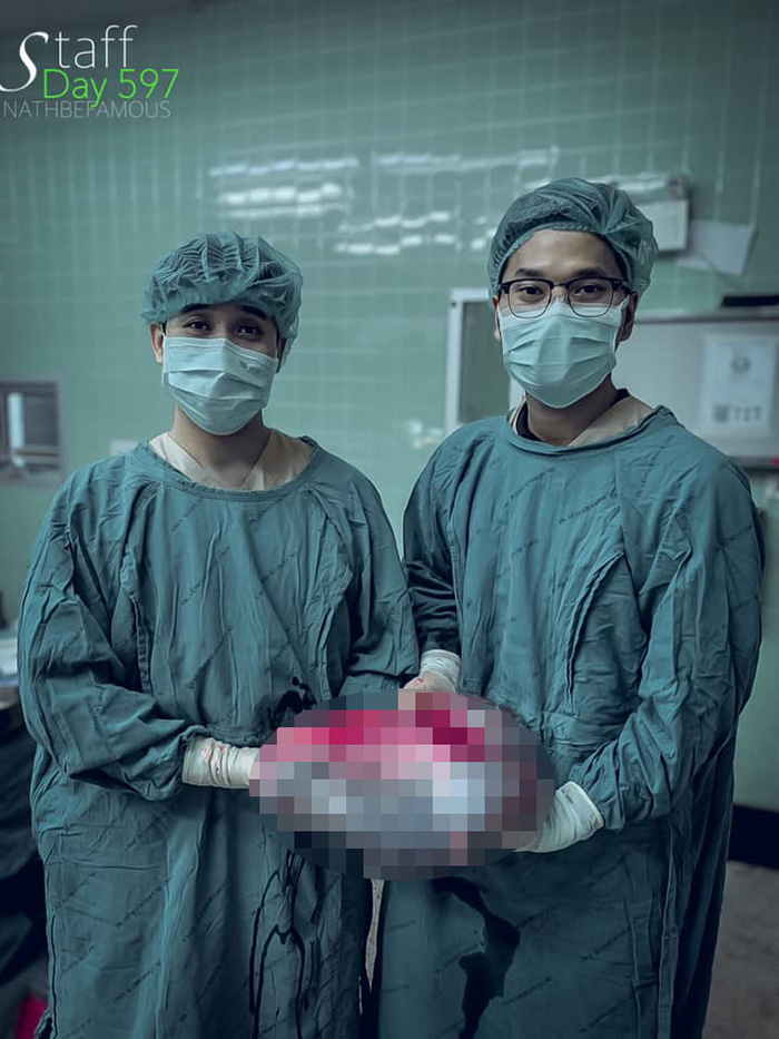 เนื้องอกยักษ์