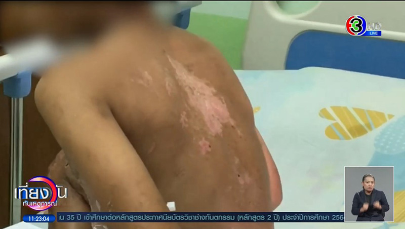 น้องภูผา