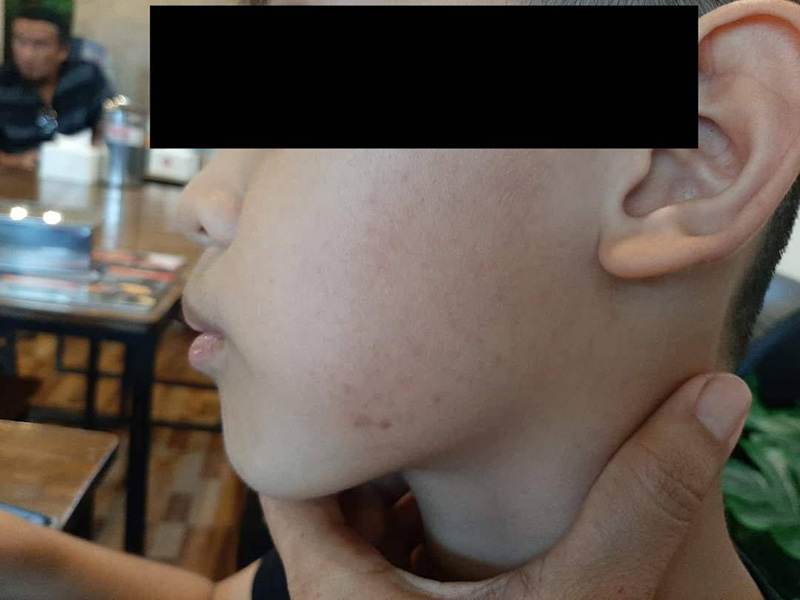 โพสต์หลานโดนครูสั่งให้เพื่อนรุมตบ