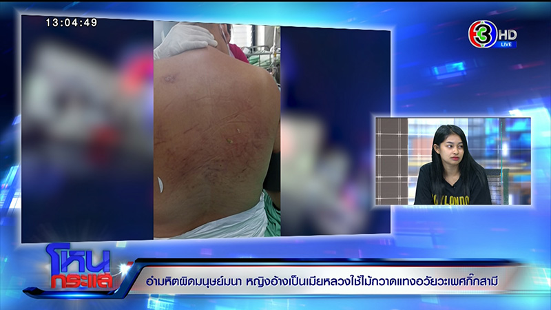 ลูกสาวร้องแม่ถูกเมียหลวงใช้ไม้กวาดแทงอวัยวะเพศ