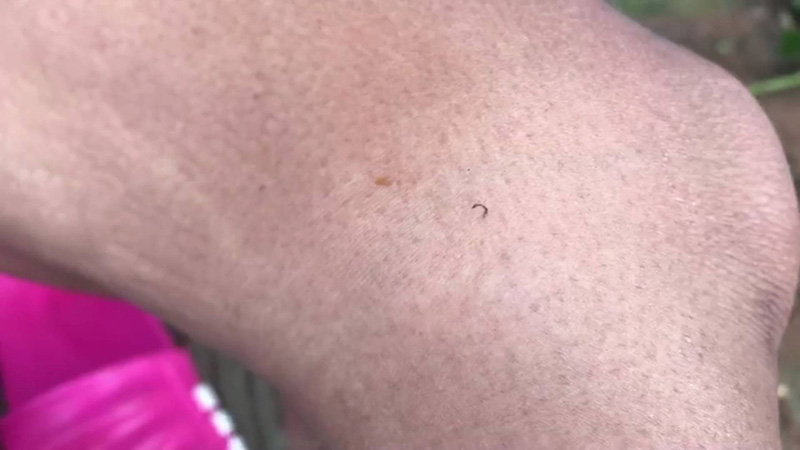 หญิงป่วยประหลาด 