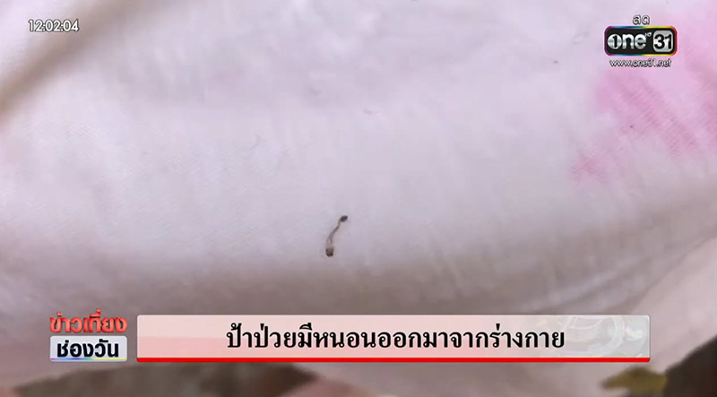 หญิงป่วยประหลาด 