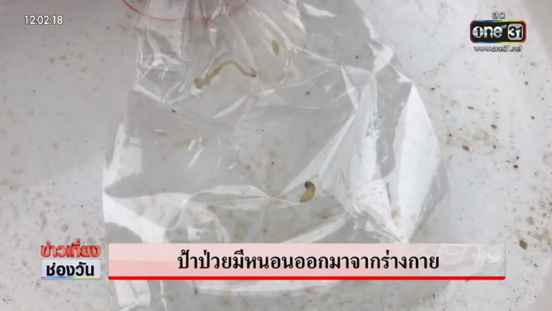 หญิงป่วยประหลาด 