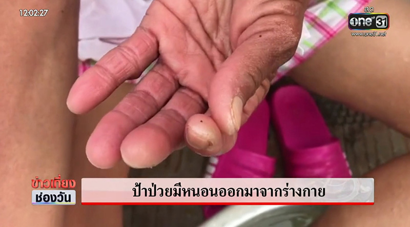 หญิงป่วยประหลาด 