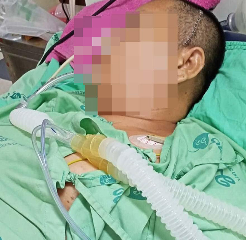 เมียน้อยถูกเมียหลวงยกพวกรุมทำร้าย