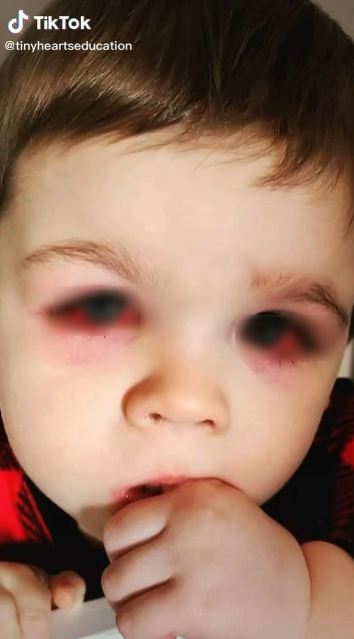 ลูกชายติดเชื้อ