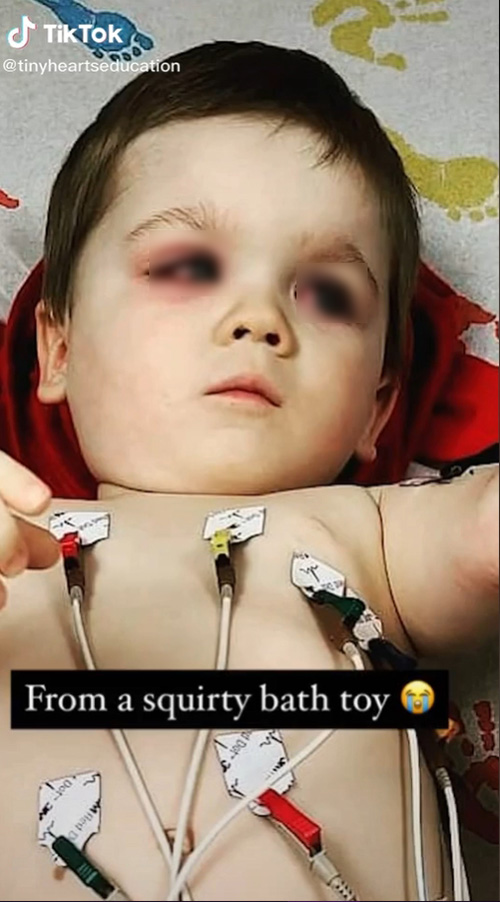 ลูกชายติดเชื้อ