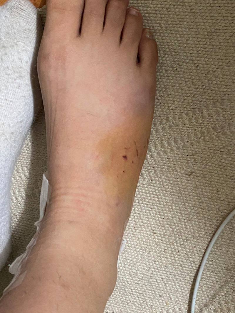 อุทาหรณ์คนเลี้ยงแมว ! 